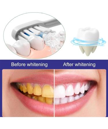 Artisan Probiotic Toothpaste for Sensitive Teeth - Brightening & Restorative Formula (1PC) - International Shipping - Buy Online on GoSupps.com