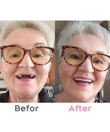 airmor Do It Yourself Denture Fake Teeth Top and Bottom Temporary Teeth Easy and Convenient Common to All situations-2 - Buy Online on GoSupps.com