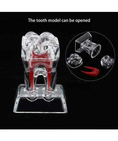 Discriminable Toothed Tooth Model for Endodontics | Plastic Teeth Teaching Material for Dental Studies & Research | International Shipping Available - Buy Online on GoSupps.com