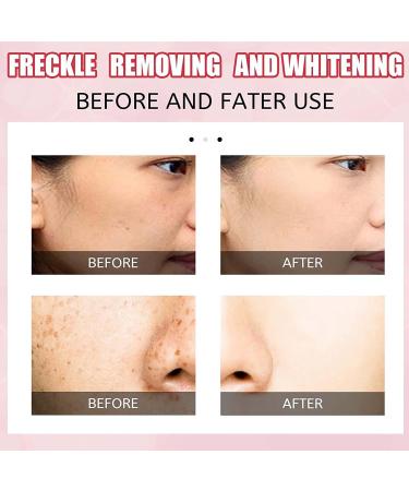 3 Days Koji Acid Whitening Moisture Cream - Dark Spot Correction Skin Lightening & Hydration - Buy Online on GoSupps.com