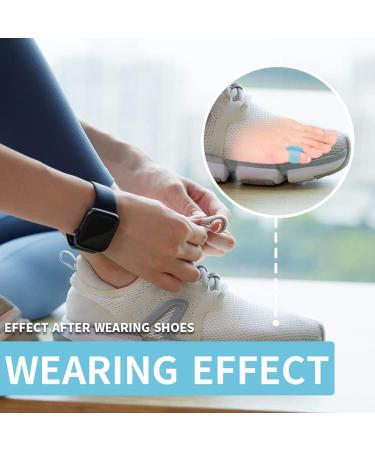 12 Pack Gel Little Toe Separators & Spacers - Pinky Toe Cushions for Preventing Rubbing & Relieving Pressure - Overlapping Toe Corrector (5 Colours) - Buy Online on GoSupps.com