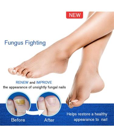 Nail Regeneration Bio-Pen 2Pcs Set for Effective Fragile Nail Repair - Men Women (Blue) - Buy Online on GoSupps.com