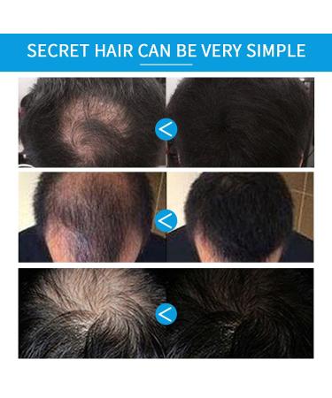 2-in-1 Hair Fibers Kit - Black Hair Thickening Fibers with Spray Applicator Pump - Instantly Thick & Full Hair in 15 Seconds - For Men and Women - Buy Online on GoSupps.com