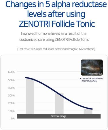 ZENOTRI Hair Care Follicle Tonic with Biotin & DHT Blocker - Promotes Hair Regrowth, Nutrition, and Scalp Odor Removal for All Hair Types - Men and Women - Buy Online on GoSupps.com