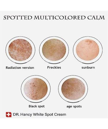 Kunnozz Japanese Melasma Cream - Dr. Hancy Herbal White Spot Treatment (3pcs) - Buy Online on GoSupps.com