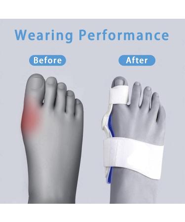 Bunion Corrector - Orthopedic Toe Straightener for Women and Men | Adjustable Bunion Splint for Pain Relief - Buy Online on GoSupps.com