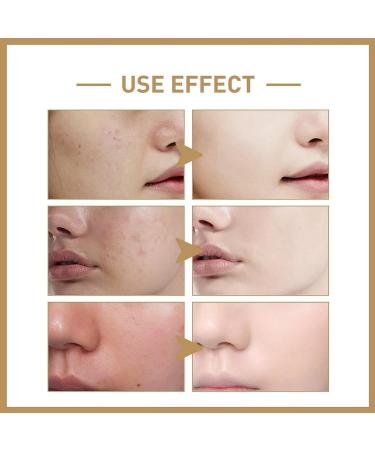 Face Moisturiser Retinoid 2% Emulsion Skincare Retinol Face Serum Anti Wrinkle Serum Retinol Face Serum Brightening Serum Brighten & Smooth Skincare Face Serum For Women & Men Serums Skincare - Buy Online on GoSupps.com