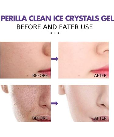 Gel Nettoyant Aux Cristaux De Glace For Affiner Les Pores Et claircir La Peau - Nettoie En Profondeur Minimise Les Pores R duit L'acn Les Points Noirs Et Blancs For Une Peau Lisse(2PCS) - Buy Online on GoSupps.com