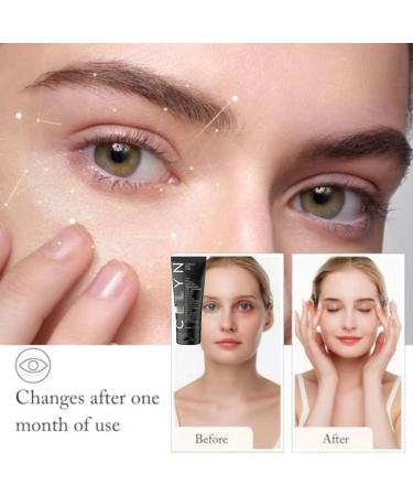 Celyn Eye Cream Set: Instant Firming, Tightening & Moisturizing Formula (2PCS) - Buy Online on GoSupps.com