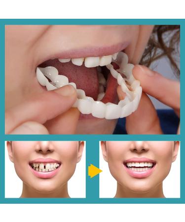 6 PCS Fake Teeth Veneers for Upper and Lower Jaw - Natural Shade Cosmetic Dentures for Christmas and Daily Use - Buy Online on GoSupps.com