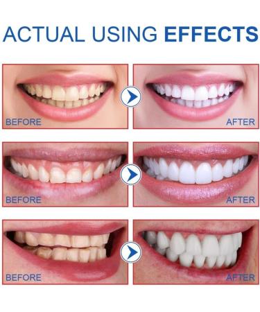 Probiotic Whitening Toothpaste Clean Mouth Odor Protect Gums & Whiten Teeth - Buy Online on GoSupps.com