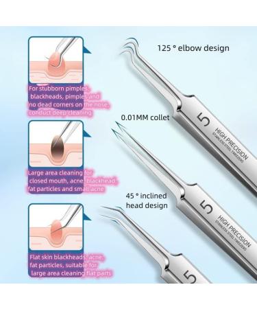 Professional Blackhead Remover Extractor Kit - Acne & Whitehead Removal Tool - Buy Online on GoSupps.com