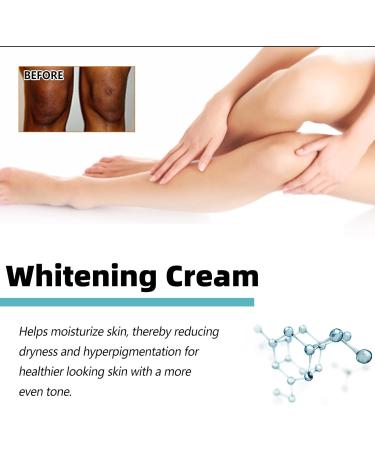 Face and Body Whitening Cream Skin Lightening Cream Body Moisturiser for Skin Lightener Skin Bleaching & Whitening Cream for Dark Skin Body Whitening Cream for Elbows Underarm Inner Thigh Knees - Buy Online on GoSupps.com