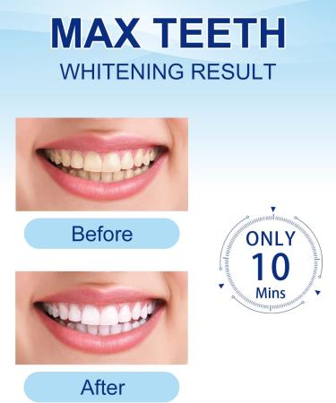 MySmile Teeth Whitening Kit with LED Light - Non-Sensitive 10 Min Whitening, Enhanced Carbamide Peroxide Pen - Removes Coffee, Smoking, Wine Stains - Buy Online on GoSupps.com