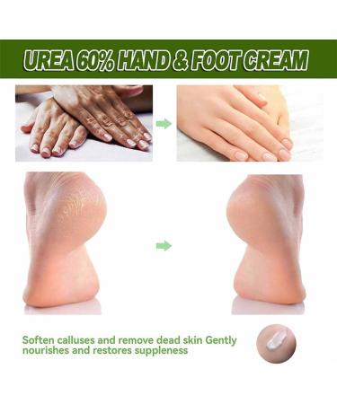  YUNFAN Urea Foot Cream Moisturizer Anti-Crack Cream Repairing Cream for Cracked Heels 2025 New Foot Creams for Cracked Heels and Dry Skin (3) - Buy Online on GoSupps.com