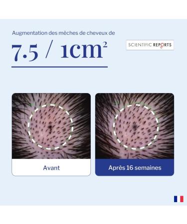 tonique revitalisant pour follicules pileux 6 ml application hebdomadaire pour des cheveux sains pour femmes et hommes - Buy Online on GoSupps.com