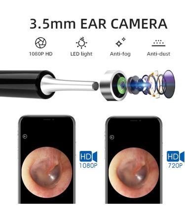 Wireless 1080P FHD Ear Wax Removal Endoscope & Otoscope for iPhone, iPad & Android - Earwax Remover Tool with 6 LED Lights - Black - Buy Online on GoSupps.com