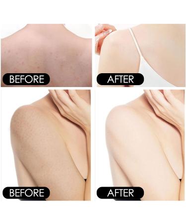 Body Moisturizer Body Cream 100g 2 Pieces for Skin Care - Buy Online on GoSupps.com