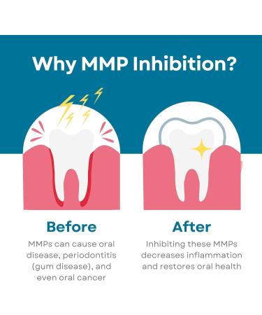 Fluoride-Free Nano-Hydroxyapatite Toothpaste Whitening Sensitive Teeth MMP Inhibiting Antiplaque Remineralizing Created by Doctors + Dentists for Gum Health SLS-Free Made in USA 4oz 2-Pack - Buy Online on GoSupps.com