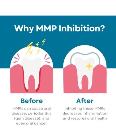 Fluoride-Free Nano-Hydroxyapatite Toothpaste Whitening Sensitive Teeth MMP Inhibiting Antiplaque Remineralizing Created by Doctors + Dentists for Gum Health SLS-Free Made in USA 4oz 3-Pack - Buy Online on GoSupps.com