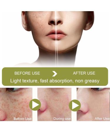 EXQST Advanced Whitening and Lightening Cream Anti-Freckle and Whitening Cream Lightening and Whitening Cream Body Whitening Cream - Buy Online on GoSupps.com