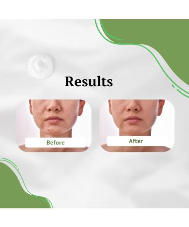 Aloe Vera Gel Cleanser for All Skin Types | Treat Acne Dark Spots & Eczema - Face Wash for Men & Women - Buy Online on GoSupps.com