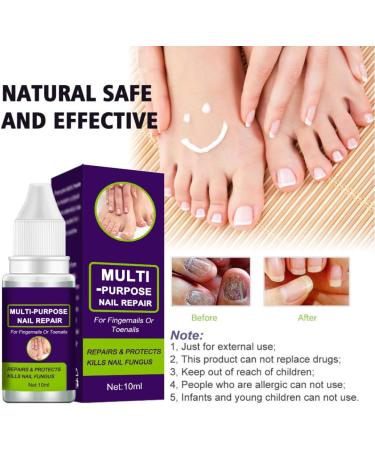 Nail Repair Toenail Care Solution Multi-purpose Renewl Restores Discolored and Damaged Nails 10 ML cracked nail repair gel - Buy Online on GoSupps.com