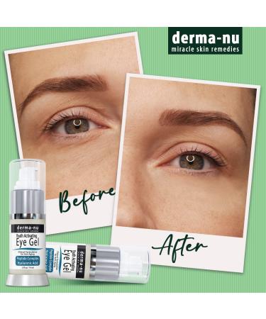 Anti-Aging Eye Gel Cream for Dark Circles, Puffiness & Wrinkles - Hyaluronic Acid Serum with Aloe Vera & Jojoba - 5 oz - Pack of 1 - Buy Online on GoSupps.com