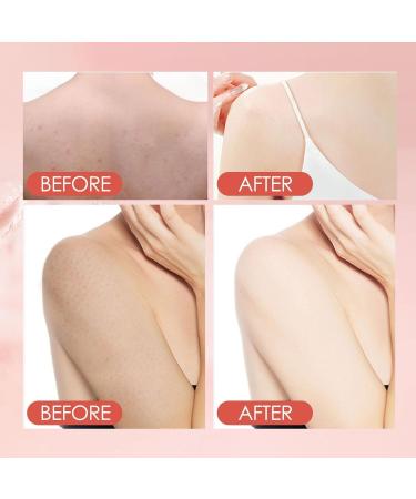 New Mud Gel Full Body Exfoliating Mud Gel Body Mud Scrub Exfoliating Face Scrub Deep Cleansing Cuticles and Dirt - Buy Online on GoSupps.com