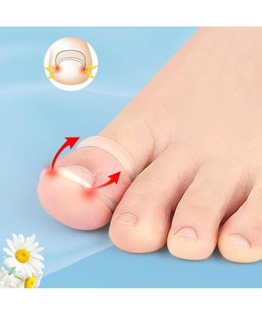Ingrown Toenail Corrector Ring Washable Transparent Lightweight Silicone Ingrown Toenail Tool for Nail Care - Buy Online on GoSupps.com