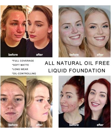 Allbesta Soft Radiant Concealer Foundation for Face Medium Coverage Base 30 ml - Buy Online on GoSupps.com