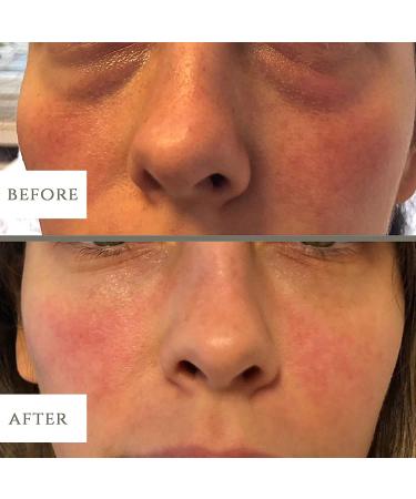 LuxeBiotics Natural Under Eye Treatment - Dark Circle & Puffiness Remover - Buy Online on GoSupps.com