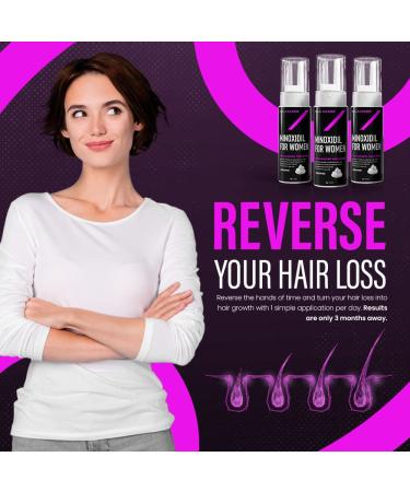 FolliGuard 5% Minoxidil Foam for Women - 3 Month Supply | Hair Growth Treatment with Biotin, DHT Blockers, Vitamins, and Herbs - Buy Online on GoSupps.com