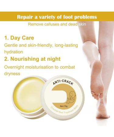 Fengyang 2 x Anti-Crack Foot Cream Anti-Tear Cream Anti-Crack Heel Cream Anti Crack Foot Creams for Dry Rough Hands - Buy Online on GoSupps.com