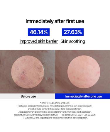 MILLIMILLI MediAmpoule Cica Serum | Calming Centella Asiatica Face Ampoule with TECA & Panthenol | Hydrating Korean Skin Care Serum for Face 15ml - Buy Online on GoSupps.com