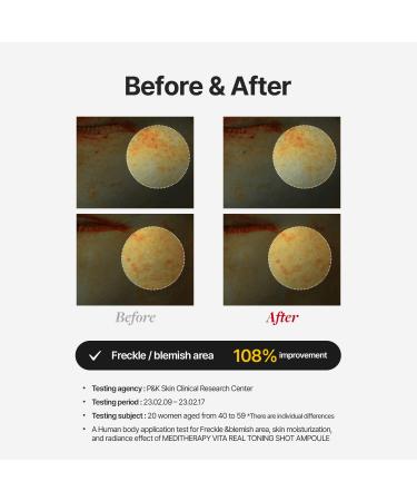 Buy MEDITHERAPY VITA REAL Shot Toning Ampoule | Pure Vitamin C Serum for Blemish Care & Radiance | Korean Skincare - 0.5 fl. oz - Buy Online on GoSupps.com