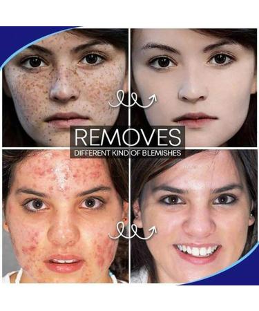 Pro.W Flaw Cream - Non-Irritating Acne Spot Treatment for Face | Anti-Macule Scar Freckles & Dark Spots Repair - Buy Online on GoSupps.com