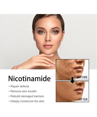 Niacinamide Freckles Removal Serum Niacinamide Spots Removal Serum Niacinamide Serum Nicotinamide Serum for Blemishes Niacinamide Serum for Face and Body for All Type Skin - Buy Online on GoSupps.com
