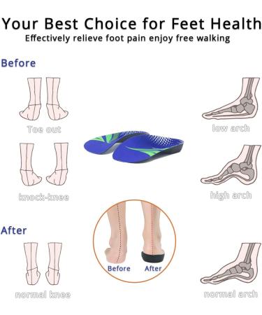 Orthotic 3/4 Length Insoles for Over Pronation & High Arch Support - Men's 6.5-8.5, Women's 7.5-9.5 - Buy Online on GoSupps.com