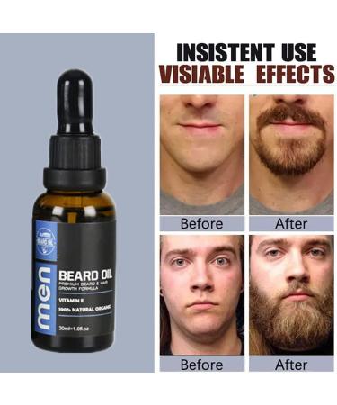 Premium Beard Oil for Men | Stimulate Growth & Regrowth | Thick & Masculine Facial Hair Treatment - Buy Online on GoSupps.com