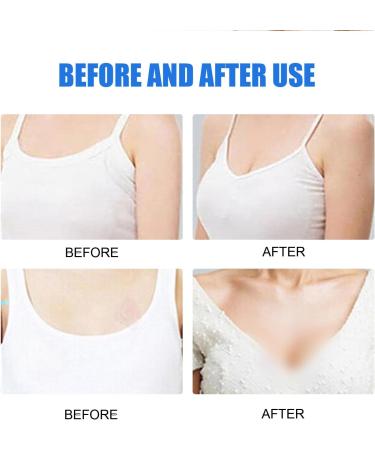 Breast Lifting Essence Lift and Enlarge Chest Breast Enhancement Oil Firming Tightening Big Boobs Enlargement Essence Nourishing to Push up Bust Lifting And Tightening Cream For Growth - Buy Online on GoSupps.com