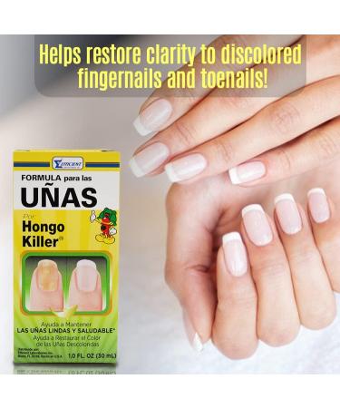 Hongo Killer Nail Formula 1 oz - Pack of 6 | Fast-Acting Treatment - Buy Online on GoSupps.com