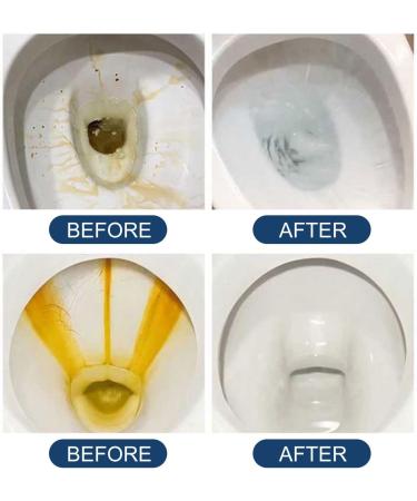 KOAHDE WC Cleaning Tablets Toilet Fresh Tablets Toilet Bowl Deep Cleaning Tablets Power Fizz Tablets WC Automatic Cleaning Tablets Toilet Cleaner Tablets Toilet Cistern Cleaning Tablets 10Pcs - Buy Online on GoSupps.com