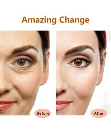 Golden 3D Electric Face Massage Roller Kit for Puffiness Relief - Buy Online on GoSupps.com