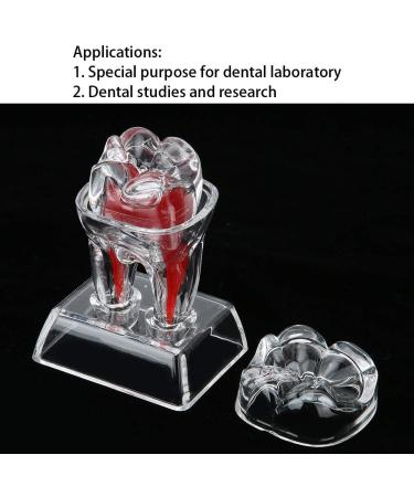 Discriminable Toothed Tooth Model for Endodontics | Plastic Teeth Teaching Material for Dental Studies & Research | International Shipping Available - Buy Online on GoSupps.com