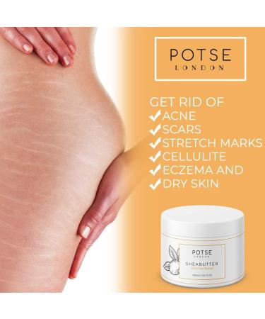 Shea Butter Stretch Cream for Body and Hair - Anti-Stretch Mark Cream Pregnancy Cellulite Stretch Mark Remover Psoriasis treatment with Lavender Oil 100ml - Buy Online on GoSupps.com