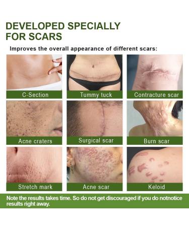 flysmus Advanced Scar Repair Serum - Medical Grade Spray for All Types of Scars (1PCS) - Buy Online on GoSupps.com