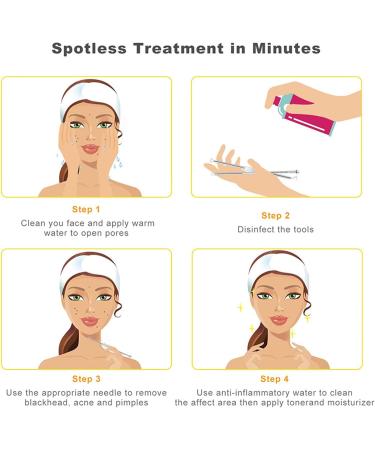 Rosarden Blackhead Remover Tool Kit 4 Pieces Comedone Extractor Tool Blemish Whitehead Removal Acne Needle Pimple Spot Popper Stainless Steel (Color) Gold - Buy Online on GoSupps.com