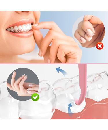 ARGOMAX - Aligner Removal Tool 2 Retainer Remover Tool Invisible Braces Removal Tools Suitable for Removing Braces Trays Retainers Dentures and Aligners(Blue+Pink). Medium size 2pcs Pink+Blue - Buy Online on GoSupps.com