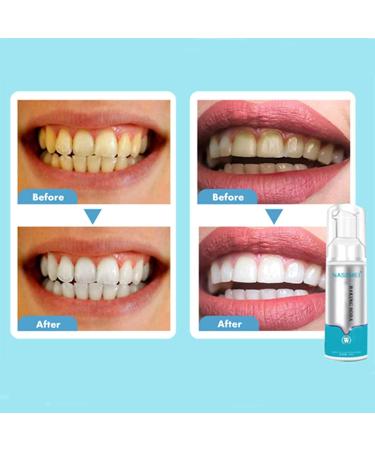 Fluoride-Free Whitening Toothpaste Foam - 3PCS Mousse Cleansing & Stain Removal with Baking Soda | 60ml - Buy Online on GoSupps.com